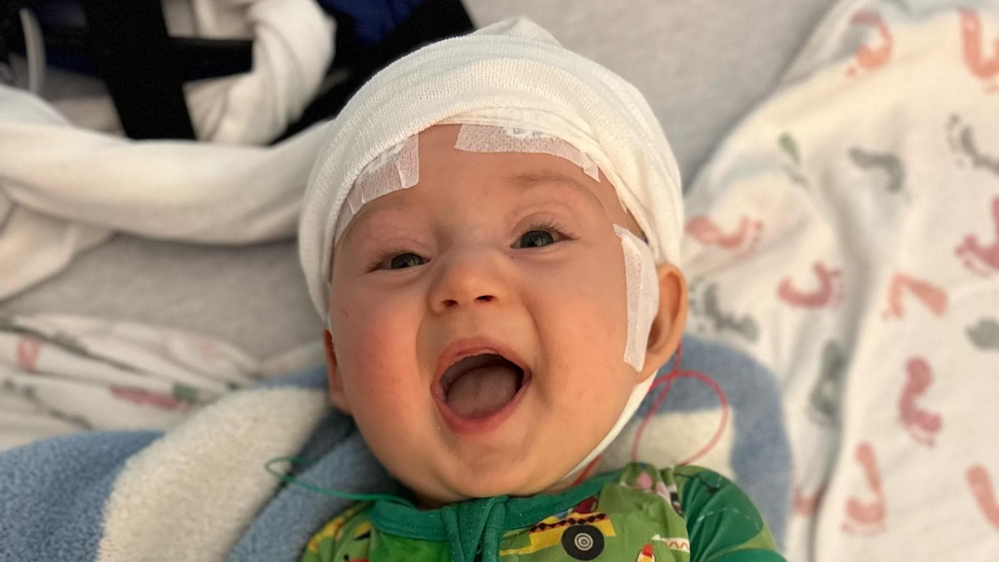 One of our Warriors, Jace, during a hospitalization wearing an EEG to monitor seizure activity.